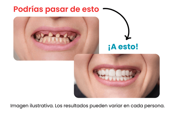 Coronas-Dentales-Dentista-En-Tijuana-Dra-Dalia-Galindo-1 (1)