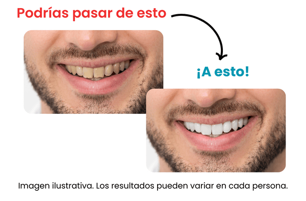 Limpieza-Dental-Con-Ultrasonido-Dentista-En-Tijuana-Dra-Dalia-Galindo-2 (1)